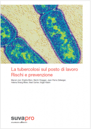 La tubercolosi sul posto di lavoro: Rischi e prevenzione