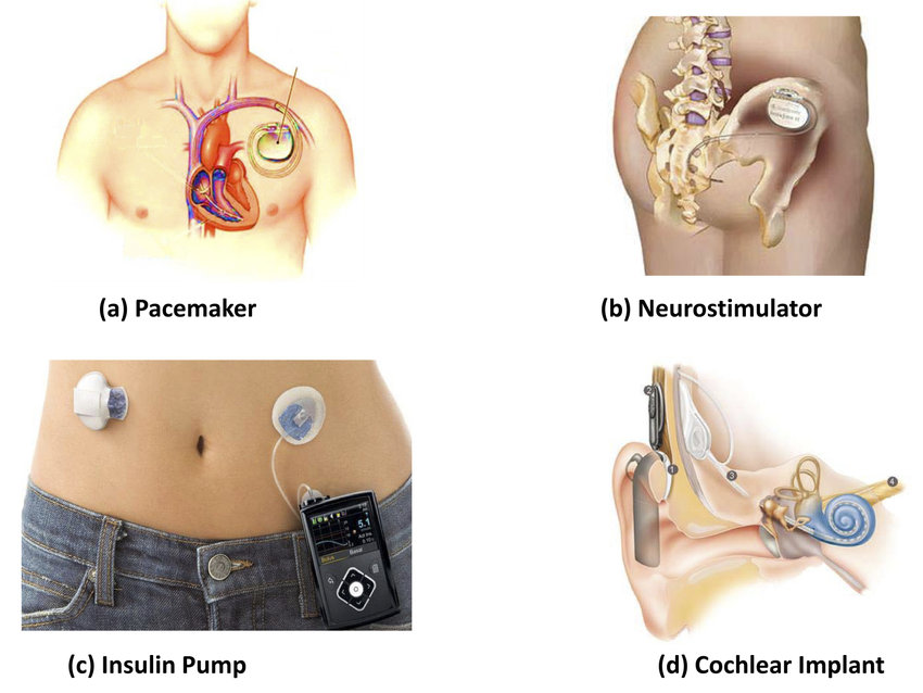 DMIA   Example